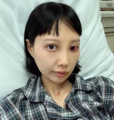女歌手李明蔚个人资料-歌手李明蔚癌细胞扩散轮椅代步，长期吸氧令人鼻酸