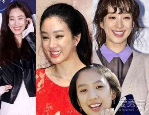 韩国整容有后遗症吗，6位爆红的初代韩流女演员是