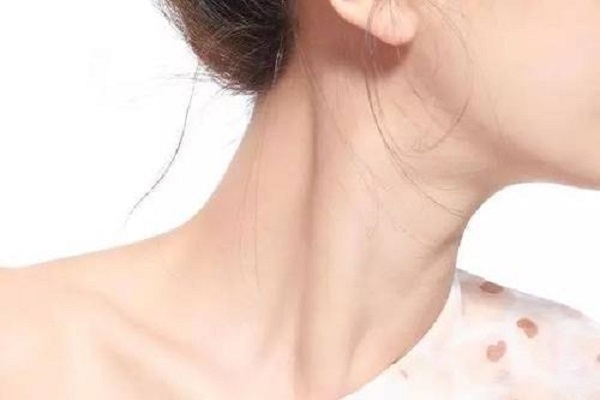 女生颈纹是怎么形成的 去除颈纹的最好办法是什么