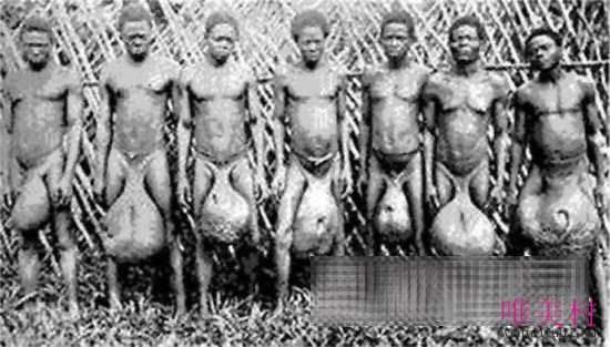 世界上最大的睾丸民族是哪个族 非洲的一个原始部落叫什么
