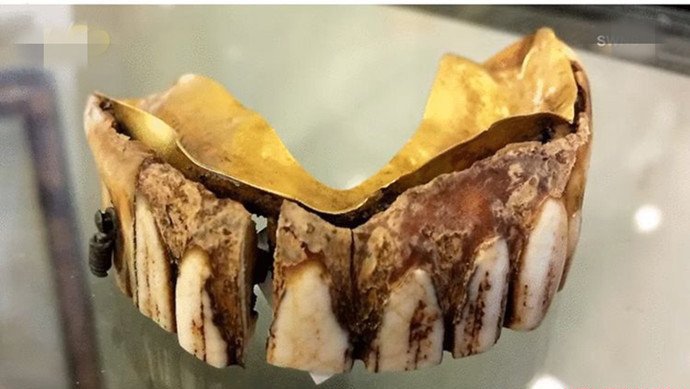 假牙为什么用黄金 河马 牙齿
