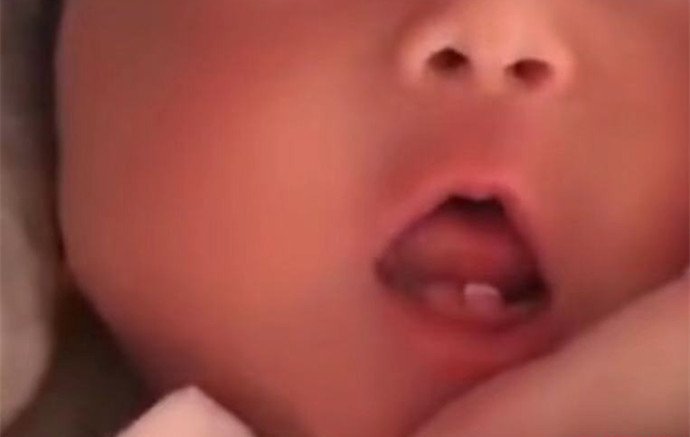 女婴出生长两颗牙怎么回事 这样的概率是比较低的英文