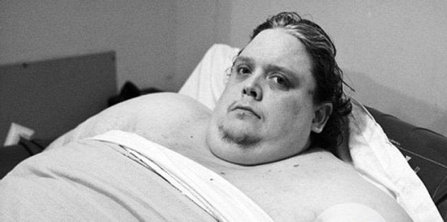 美国每年肥胖死亡 无法站立超过30秒怎么办